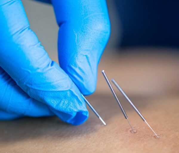 acupuntura-no-outono:-fortalecimento-da-imunidade-e-prevencao-de-doencas-respiratorias